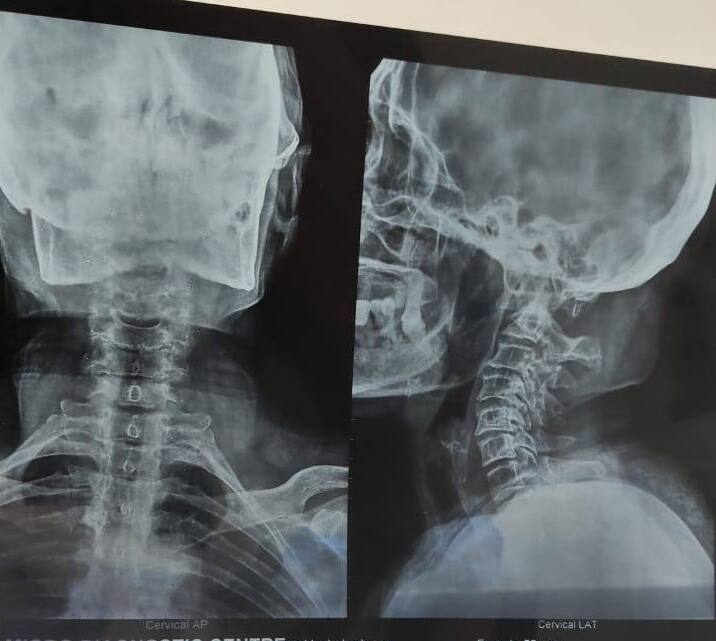 Neck-X-Ray